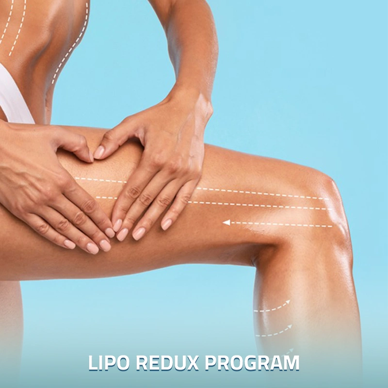 Lipo-Redux-Program